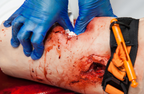 SIMBODIES - Thigh Packing Wound Trainer